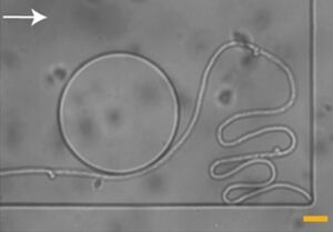 A fungal hypha stuck in a corner